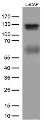 AR Antibody in Western Blot (WB)