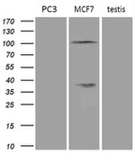 AR Antibody in Western Blot (WB)