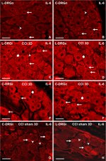 IL-6 Antibody in Immunohistochemistry (IHC)