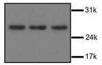 ARCH Monoclonal Antibody (1G4)