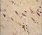 ARF1 Antibody in Immunohistochemistry (IHC)