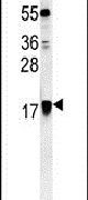ARF1 Antibody in Western Blot (WB)