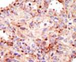 ARFGAP1 Antibody in Immunohistochemistry (IHC)