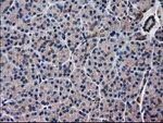 ARFGAP1 Antibody in Immunohistochemistry (Paraffin) (IHC (P))