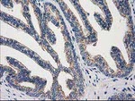 ARFGAP1 Antibody in Immunohistochemistry (Paraffin) (IHC (P))