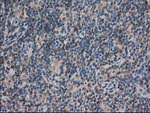 ARFGAP1 Antibody in Immunohistochemistry (Paraffin) (IHC (P))