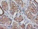 ARFGAP1 Antibody in Immunohistochemistry (Paraffin) (IHC (P))