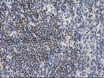 ARFGAP1 Antibody in Immunohistochemistry (Paraffin) (IHC (P))