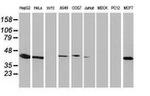 ARFGAP1 Antibody in Western Blot (WB)
