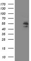 ARFGAP1 Antibody in Western Blot (WB)