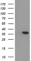 ARG1 Antibody in Western Blot (WB)