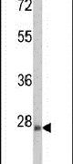 ARHE Antibody in Western Blot (WB)