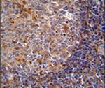 ARHGAP25 Antibody in Immunohistochemistry (IHC)
