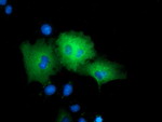 ARHGAP25 Antibody in Immunocytochemistry (ICC/IF)