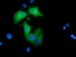 ARHGAP25 Antibody in Immunocytochemistry (ICC/IF)