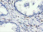 ARHGAP25 Antibody in Immunohistochemistry (Paraffin) (IHC (P))