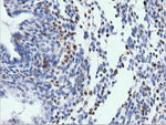 ARHGAP25 Antibody in Immunohistochemistry (Paraffin) (IHC (P))