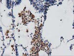 ARHGAP25 Antibody in Immunohistochemistry (Paraffin) (IHC (P))