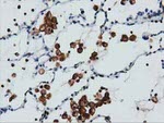 ARHGAP25 Antibody in Immunohistochemistry (Paraffin) (IHC (P))
