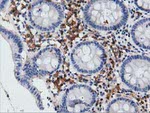 ARHGAP25 Antibody in Immunohistochemistry (Paraffin) (IHC (P))