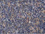 ARHGAP25 Antibody in Immunohistochemistry (Paraffin) (IHC (P))