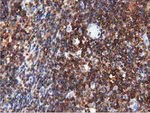 ARHGAP25 Antibody in Immunohistochemistry (Paraffin) (IHC (P))