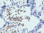 ARHGAP25 Antibody in Immunohistochemistry (Paraffin) (IHC (P))
