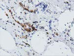 ARHGAP25 Antibody in Immunohistochemistry (Paraffin) (IHC (P))