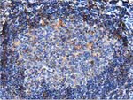 ARHGAP25 Antibody in Immunohistochemistry (Paraffin) (IHC (P))