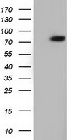ARHGAP25 Antibody in Western Blot (WB)