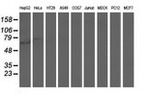 ARHGAP25 Antibody in Western Blot (WB)