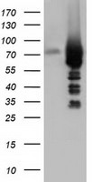 ARHGAP25 Antibody in Western Blot (WB)
