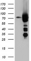 ARHGAP25 Antibody in Western Blot (WB)