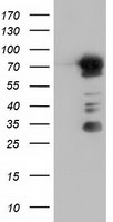 ARHGAP25 Antibody in Western Blot (WB)