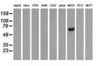 ARHGAP25 Antibody in Western Blot (WB)