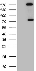 ARHGAP5 Antibody in Western Blot (WB)