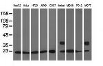 ARHGDIA Antibody in Western Blot (WB)