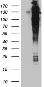 ARHGEF18 Antibody in Western Blot (WB)