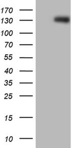 ARHGEF18 Antibody in Western Blot (WB)