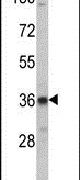 LDLRAP1 Antibody in Western Blot (WB)