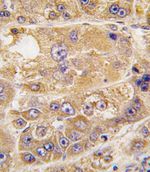 LDLRAP1 Antibody in Immunohistochemistry (IHC)