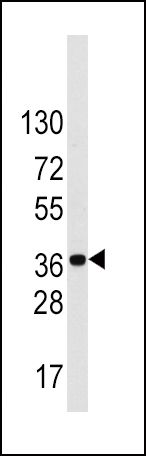 LDLRAP1 Antibody in Western Blot (WB)