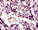 ARL1 Antibody in Immunohistochemistry (IHC)
