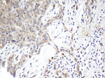 ARL2BP Antibody in Immunohistochemistry (Paraffin) (IHC (P))