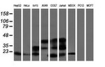 ARL2BP Antibody in Western Blot (WB)