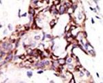 ARL3 Antibody in Immunohistochemistry (IHC)