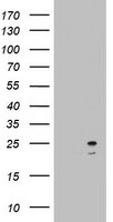 ARL3 Antibody in Western Blot (WB)