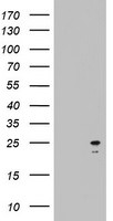 ARL3 Antibody in Western Blot (WB)