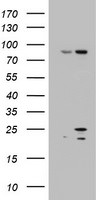 ARL3 Antibody in Western Blot (WB)
