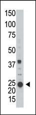 ARL3 Antibody in Western Blot (WB)